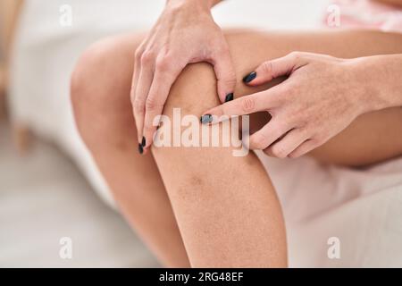 Jeune femme blonde pointant vers un hématome dans la chambre Banque D'Images