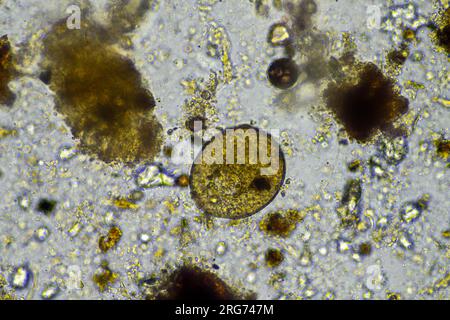 arcella dans un échantillon de tissu dans un laboratoire Banque D'Images