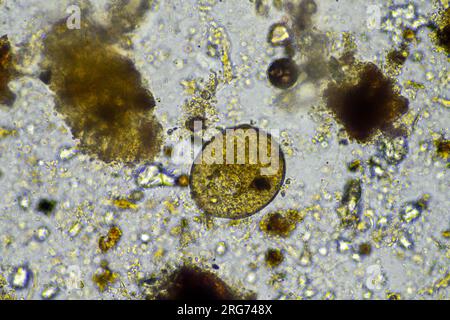arcella dans un échantillon de tissu dans un laboratoire Banque D'Images