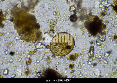 arcella dans un échantillon de tissu dans un laboratoire Banque D'Images