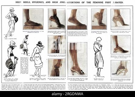 Une double page de The Sketch rapportant les contraintes contre nature exercées sur les pieds par le port de talons hauts, qui avait été interdit par la profession médicale française étant mauvais pour les pieds et encourageant une mauvaise posture. Il a été conseillé aux femmes qui s'opposaient à avoir les pieds plats de porter des talons ne dépassant pas quatre centimètres. Les croquis parmi les radiographies sont du célèbre dessinateur français, Sem. Banque D'Images