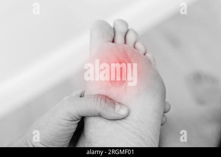 Gros plan photo noir et blanc de la plante du pied de la femme avec callosité douloureuse avec point rouge. Femelle souffre de douleurs dues au maïs sur la jambe.le problème est du Banque D'Images