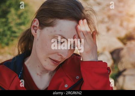 Portrait d'une femme triste avec la varicelle dehors Banque D'Images