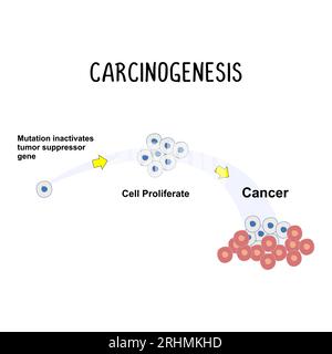 Carcinogenèse : le processus de développement du cancer, impliquant des mutations génétiques et des changements dans le comportement cellulaire. Illustration de Vecteur