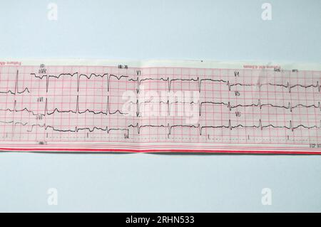 Un ECG d'électrocardiographe, un graphique qui tire l'électricité du cœur et donne une idée de la condition cardiaque et du rythme et exclut tout an Banque D'Images