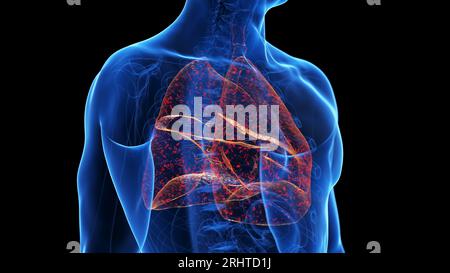 Infection pulmonaire, illustration Banque D'Images