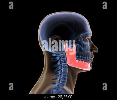 Radiographie de la mandibule en rouge Banque D'Images