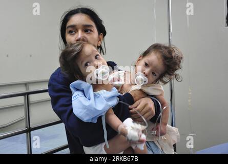 Bildnummer: 54485907  Datum: 28.09.2010  Copyright: imago/Xinhua (100929) -- PANAMA CITY, Sept. 29, 2010 (Xinhua) -- Sara Gil holds her daughters Hannah Yinneth (L) Fernandez and Hannah Yanneth Fernandez before doctors separated the conjoined twins in Panama City, Panama, Sept. 28, 2010. The one-year-old twin girls connected at the abdomen were surgically separated Tuesday by a team of 50 doctors, marking Panama s first medical operation of this kind. (Xinhua) (gj) PANAMA-PANAMA CITY-CONJOINTED TWINS-SURGERY PUBLICATIONxNOTxINxCHN Gesellschaft siamesische Zwillinge Trennung Krankenhaus Klinik Stock Photo