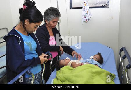 Bildnummer: 54485909  Datum: 28.09.2010  Copyright: imago/Xinhua (100929) -- PANAMA CITY, Sept. 29, 2010 (Xinhua) -- Sara Gil (1st L) looks at her daughters Hannah Yinneth Fernandez and Hannah Yanneth Fernandez before doctors separated the conjoined twins in Panama City, Panama, Sept. 28, 2010. The one-year-old twin girls connected at the abdomen were surgically separated Tuesday by a team of 50 doctors, marking Panama s first medical operation of this kind. (Xinhua) (gj) PANAMA-PANAMA CITY-CONJOINTED TWINS-SURGERY PUBLICATIONxNOTxINxCHN Gesellschaft siamesische Zwillinge Trennung Krankenhaus Stock Photo
