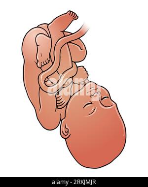 Illustration d'art de foetus à peau foncée, bébé en position céphalique d'accouchement de présentation, qui peut survenir entre 32-36 semaines, grossesse, naissance de l'enfant Banque D'Images