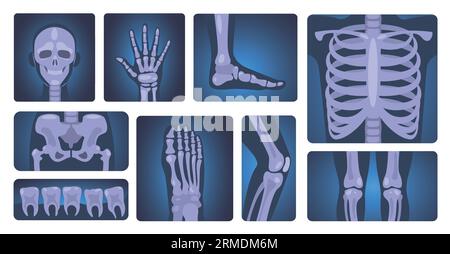 Clichés radiographiques. Squelette humain et parties du corps, diagnostic médical et concept de soins de santé, anatomie et ensemble de vecteurs scientifiques Illustration de Vecteur