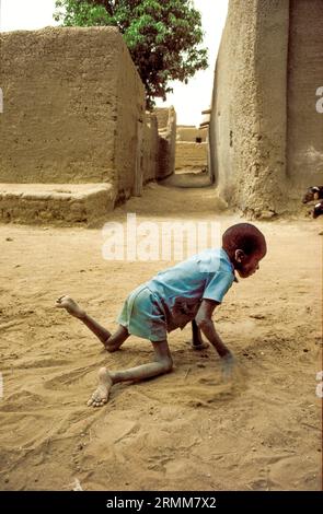 Mali, Djenne. Garçon souffrant d’ostéomalacie : minéralisation osseuse défectueuse due à une quantité nutritionnelle insuffisante de vitamine D ou de calcium. Banque D'Images