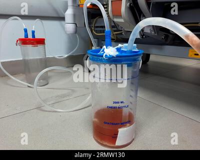 Le Caire, Egypte, août 2 2023 : Ghatwary flacon thoracique médical 2000ml, drainage d'un tube thoracique d'un cas de pneumonie d'aspiration a entraîné un épanchement pleural Banque D'Images