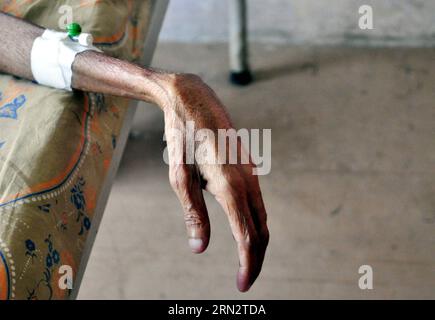 (150324) -- AGARTALA, 24 mars 2015 -- une photo prise le 24 mars 2015 montre la main d'un patient tuberculeux dans un hôpital public à l'occasion de la Journée mondiale de la tuberculose à Agartala, en Inde. La Journée mondiale de la tuberculose a pour but de sensibiliser le grand public à la maladie épidémique mondiale de la tuberculose. )(azp) INDE-AGARTALA-JOURNÉE MONDIALE DE LA TUBERCULOSE Stringer PUBLICATIONxNOTxINxCHN Mars 24 2015 une photo prise LE 24 2015 mars montre la main d'un patient tuberculeux DANS un hôpital public À L'OCCASION DE la Journée mondiale de la tuberculose en Inde la Journée mondiale de la tuberculose EST désignée pour sensibiliser le public Banque D'Images