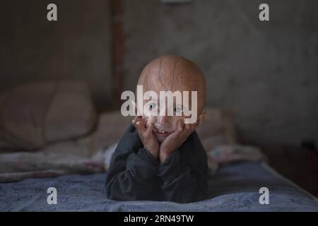 (150514) -- MORENO, 14 mai 2015 -- Franco Villavicencio, quatre ans, regarde des dessins animés à la télévision chez lui dans la ville de Moreno, dans la province de Buenos Aires, Argentine, le 13 mai 2015. Franco souffre de progeria (ou vieillissement prématuré). Les enfants atteints de cette maladie ont l'air en bonne santé à la naissance, mais au cours de la première année de vie commencent à montrer des caractéristiques de la pathologie comme une croissance plus faible, la perte de cheveux, le vieillissement de la peau, etc. Martin Zabala) (zjy) ARGENTINA-MORENO-HEALTH-PROGERIA e MARTINxZABALA PUBLICATIONxNOTxINxCHN 150514 Moreno Mai 14 2015 Franco Villavicencio quatre ans montres TV Cartoons À la maison dans le Banque D'Images