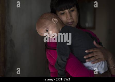 (150514) -- MORENO, 14 mai 2015 -- Franco Villavicencio (Front), âgé de quatre ans, repose dans les bras de sa mère, à son domicile dans la ville de Moreno, dans la province de Buenos Aires, Argentine, le 13 mai 2015. Franco souffre de progeria (ou vieillissement prématuré). Les enfants atteints de cette maladie ont l'air en bonne santé à la naissance, mais au cours de la première année de vie commencent à montrer des caractéristiques de la pathologie comme une croissance plus faible, la perte de cheveux, le vieillissement de la peau, etc. Martin Zabala) (zjy) ARGENTINA-MORENO-HEALTH-PROGERIA e MARTINxZABALA PUBLICATIONxNOTxINxCHN 150514 Moreno Mai 14 2015 Franco Villavicencio Front quatre ans repose dans le sien Banque D'Images