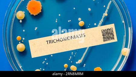 Trichomoniasis - Sexually transmitted parasitic infection that can cause genital itching and discharge. Stock Photo