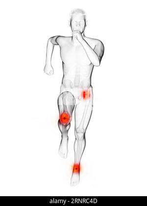 Articulations douloureuses du coureur, illustration Banque D'Images