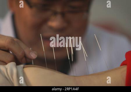 (180621) -- PÉKIN, 21 juin 2018 () -- une photo prise le 11 mars 2011 montre un médecin pratiquant l'acupuncture dans une clinique de Pékin, capitale de la Chine. La médecine traditionnelle chinoise (MTC), l'une des plus anciennes formes de médecine au monde avec différentes pratiques, y compris l'acupuncture, la thérapie de piqûre d'abeille, ventouse, moxibustion, mise au rebut, tui na (massage thérapeutique chinois), prévaut encore dans la société moderne après des milliers d'années d'évolution, au cours desquelles des générations ont restauré et maintenu la santé en fonction de lui. L'indice des maladies de l'Organisation mondiale de la Santé a été mis à jour pour inclure REFER Banque D'Images