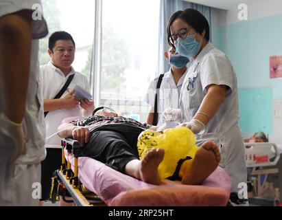 (180819) -- BEIJING, 19 août 2018 -- Un médecin examine un patient à l hôpital Tian Tan de Beijing, capitale de la Chine, le 19 août 2018, première Journée des travailleurs médicaux de la Chine. )(mcg) CHINA-BEIJING-MEDICAL WORKERS DAY (CN) ZhangxChenlin PUBLICATIONxNOTxINxCHN Banque D'Images