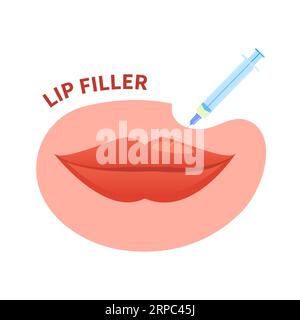 Augmentation du repulpage de remplissage des lèvres avec injection de beauté Illustration de Vecteur
