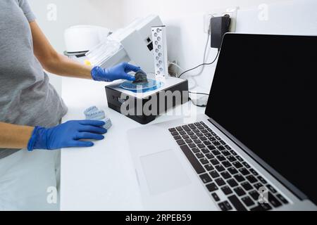 Le dentiste utilise un dispositif pour laver une impression 3D dentaire dans une solution de nettoyage, et durcir le moule en utilisant la lumière UV. Banque D'Images