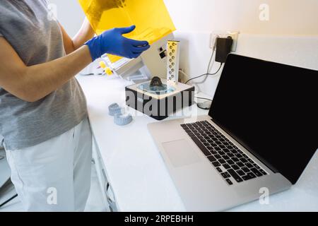 Le dentiste utilise un dispositif pour laver une impression 3D dentaire dans une solution de nettoyage, et durcir le moule en utilisant la lumière UV. Banque D'Images