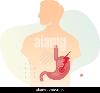 Personne souffrant de douleurs à l'estomac - Illustration du stock comme fichier EPS 10 Illustration de Vecteur