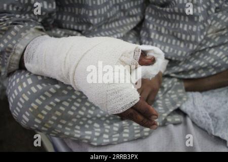 210830 -- KABOUL, 30 août 2021 -- une photo prise le 30 août 2021 montre les mains d'un blessé à l'hôpital Wazir Akbar Khan à Kaboul, capitale de l'Afghanistan. Après l’explosion meurtrière qui a tué quelque 170 Afghans et 13 soldats américains à l’aéroport de Kaboul jeudi, certains survivants ont évoqué la possibilité qu’un certain nombre d’Afghans aient été tués par des tirs américains dans le chaos et la confusion au lieu de bombarder. Photo de /Xinhua AFGHANISTAN-KABOUL-AÉROPORT SURVIVANTS DES BOMBARDEMENTS SaifurahmanxSafi PUBLICATIONxNOTxINxCHN Banque D'Images