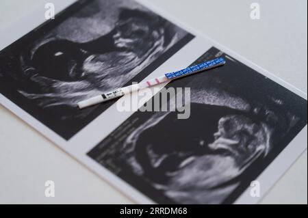 Test de grossesse positif sur une photo d'une échographie sur une table blanche. Banque D'Images