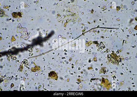 vie du sol au microscope avec champignons du sol et hyphes fongiques dans une ferme Banque D'Images