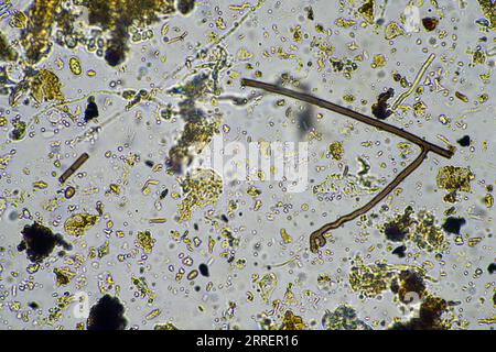 les micro-organismes du sol se rapprochent sous le microscope. dans un samlple de sol d'une ferme Banque D'Images