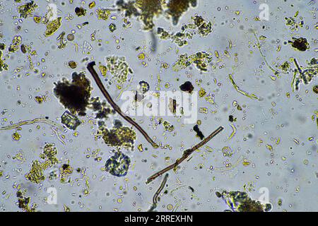 vie du sol au microscope avec champignons du sol et hyphes fongiques dans une ferme Banque D'Images