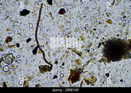 les micro-organismes du sol se rapprochent sous le microscope. dans un samlple de sol d'une ferme Banque D'Images