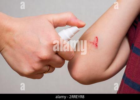 Womans Hand vaporise un agent antiseptique sur la plaie sur la main de l'enfant. Banque D'Images