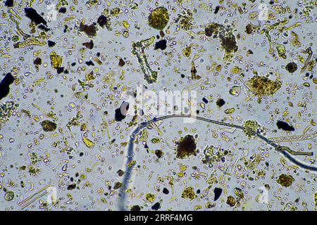 les micro-organismes du sol se rapprochent sous le microscope. dans un samlple de sol d'une ferme Banque D'Images
