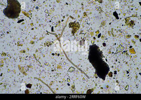 les micro-organismes du sol se rapprochent sous le microscope. dans un samlple de sol d'une ferme Banque D'Images