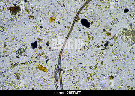 vie du sol au microscope avec champignons du sol et hyphes fongiques dans une ferme Banque D'Images