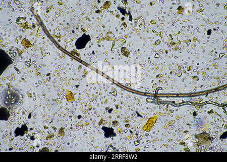 les micro-organismes du sol se rapprochent sous le microscope. dans un samlple de sol d'une ferme Banque D'Images
