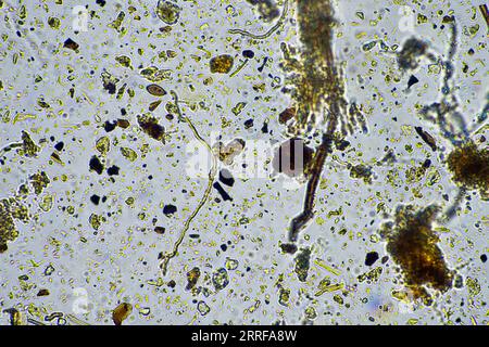 vie du sol au microscope avec champignons du sol et hyphes fongiques dans une ferme Banque D'Images