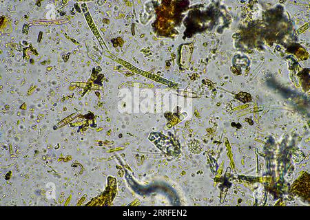 les micro-organismes du sol se rapprochent sous le microscope. dans un samlple de sol d'une ferme Banque D'Images