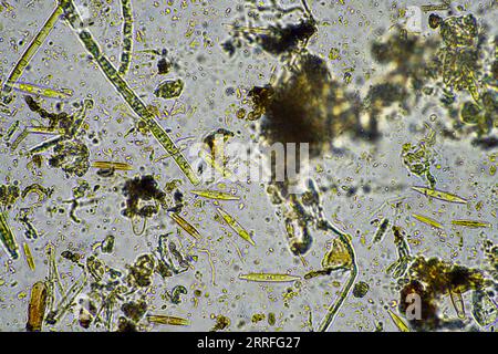 vie du sol au microscope avec champignons du sol et hyphes fongiques dans une ferme Banque D'Images