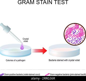 Test de coloration de Gram. Boîte de Pétri en verre avec culture bactérienne pathogène avant et après utilisation Crystal Violet. Bactéries colorées au violet de gentiane. Gram-po Illustration de Vecteur