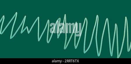 Torsades de pointes rythme cardiaque, illustration Banque D'Images