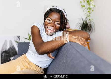 Joyeuse jeune femme africaine avec vitiligo souriant à la caméra se relaxant sur le canapé Banque D'Images