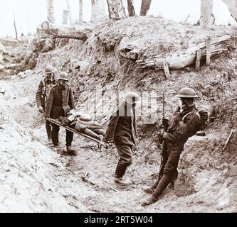 Soldats allemands capturés sous bonne garde transportant un soldat britannique blessé sur une civière à la suite des combats à Bourlon Wood sur le front occidental pendant la première Guerre mondiale. Banque D'Images