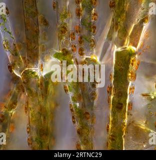 L'image présente Cladophora sp. 'Brindilles' (une sorte d'algue verte) avec Cocconeis sp. (un parent de diatomées) s'est installé dessus, photographié à travers les micros Banque D'Images
