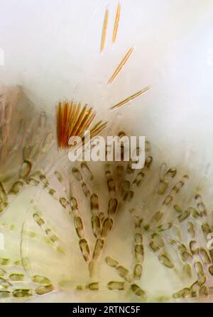 L'image présente Batrachospermum sp., une sorte d'algue rouge et une sorte de diatomées photographiées au microscope en lumière légèrement polarisée A. Banque D'Images