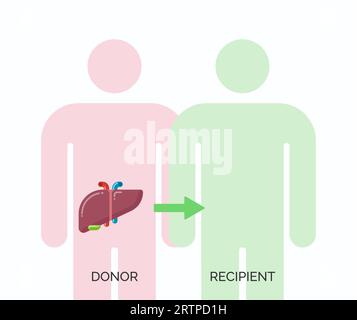 Concept de transplantation d'organes humains. Illustration vectorielle du donneur et du receveur de l'organe hépatique Illustration de Vecteur