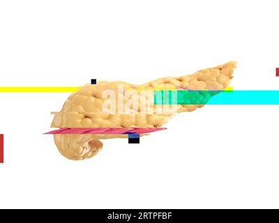 Illustration réaliste 3d d'un modèle anatomique de pancréas humain avec effet de pépin, concept d'échec Banque D'Images
